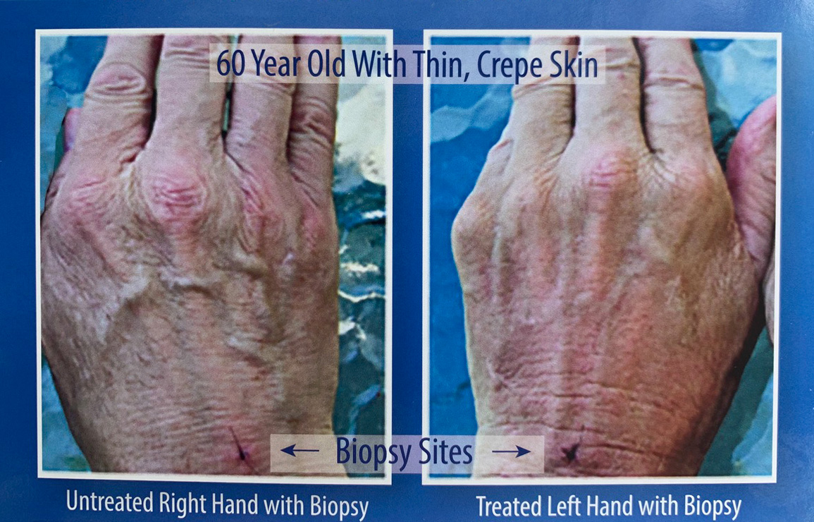 natural marine extract study hand comparison